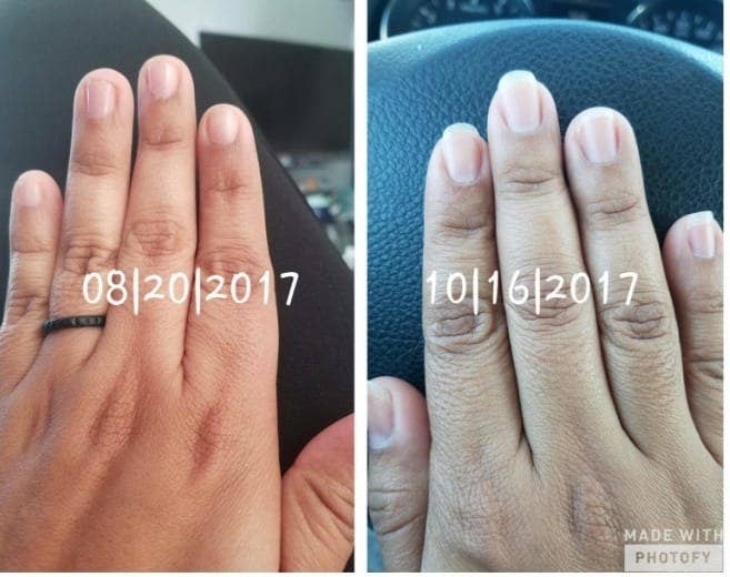 On the left, a reviewer&#x27;s nails looking short, and on the right, the same reviewer&#x27;s nails just two months later looking longer and healthier
