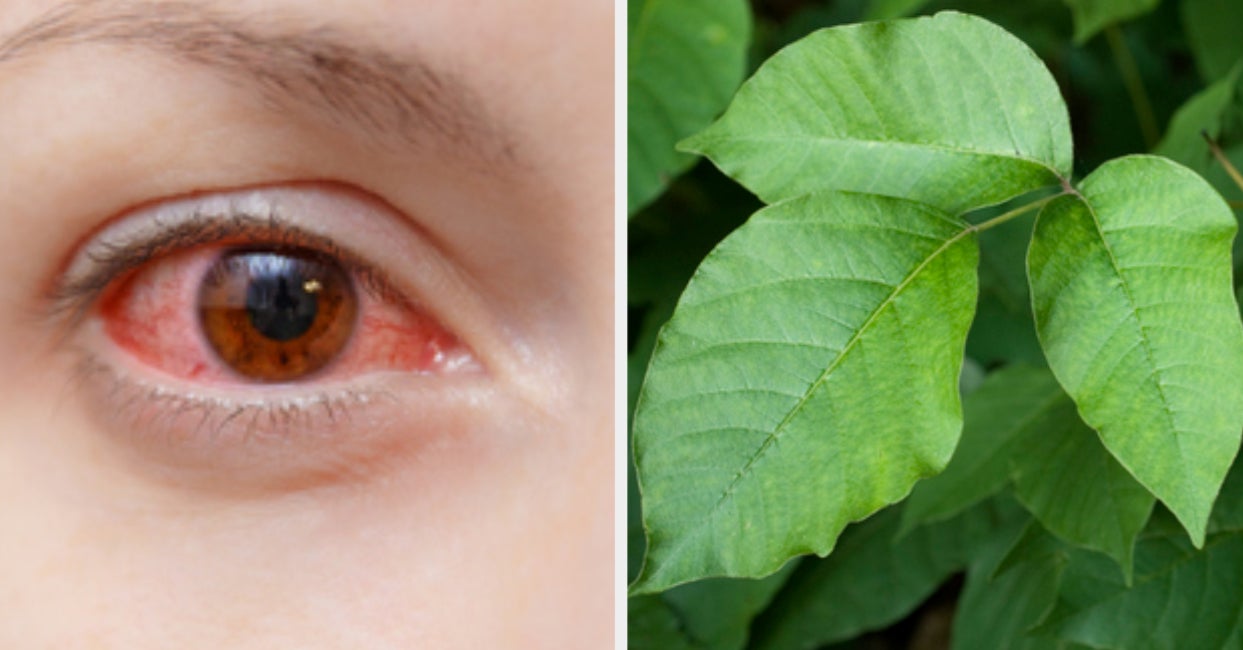 Eight Of These Plants Will Give You A Horrible Rash. Can You Pick The One That Won't?