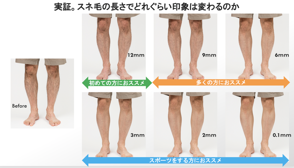 パナソニックのボディトリマーでスネ毛をケアしてみたら