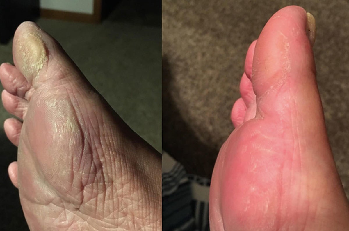 Get this foot file off  asap! Your feet will thank you! #