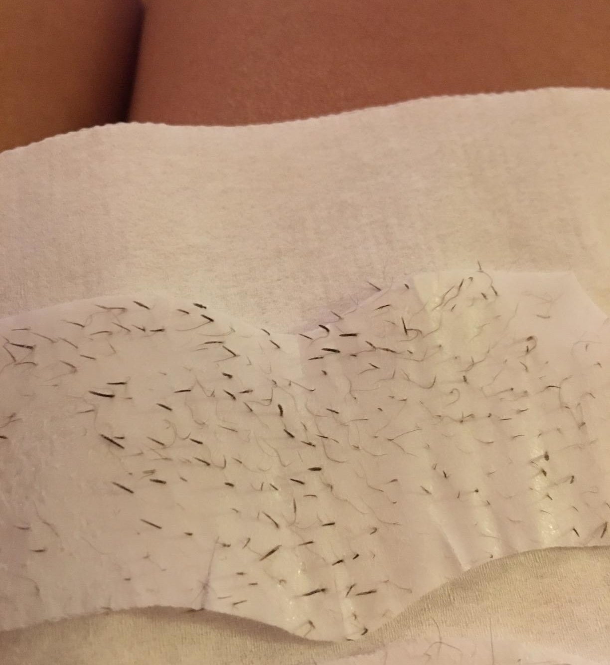 reviewer&#x27;s strip with tons of pokey blackheads pulled out