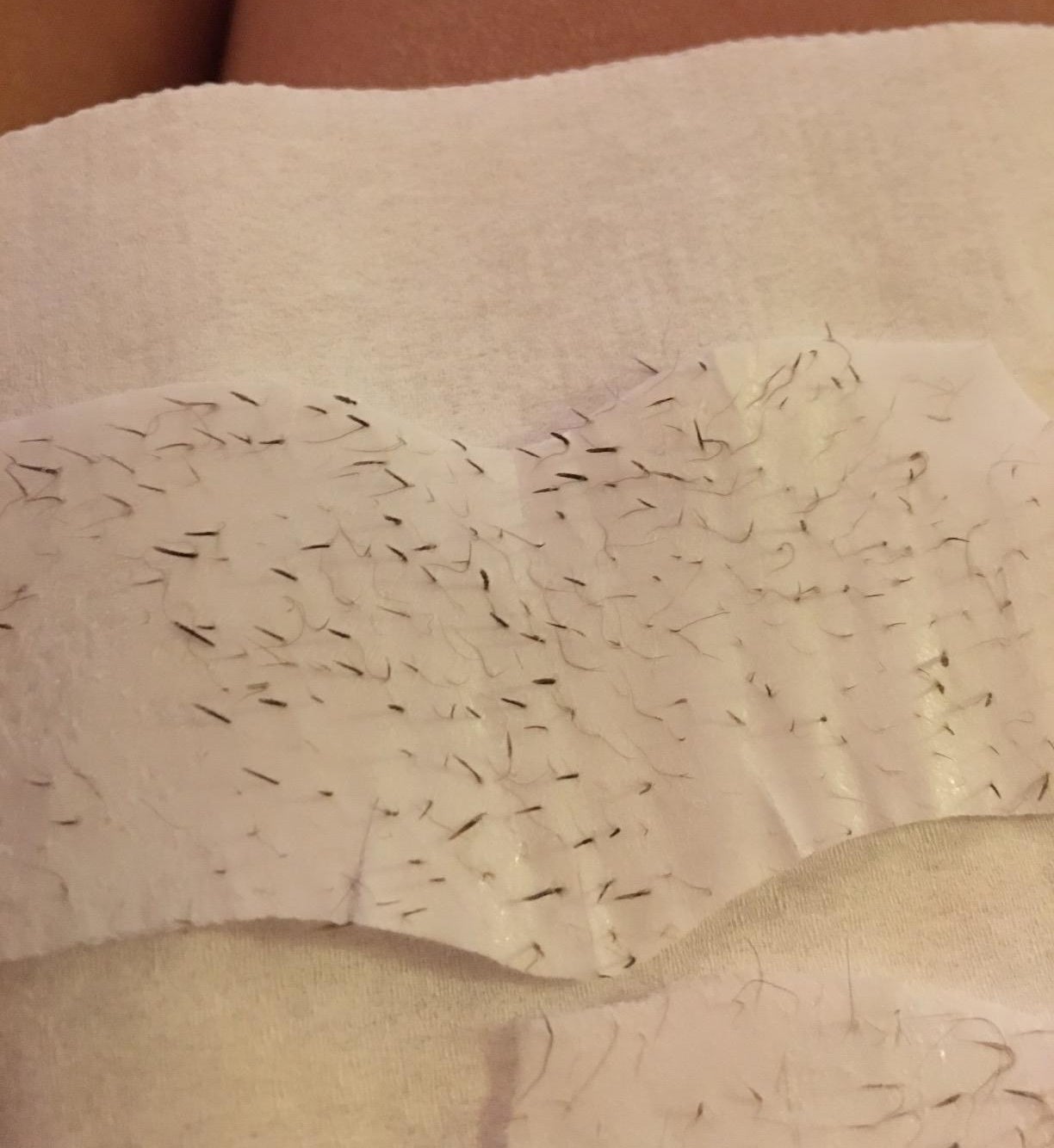 reviewer&#x27;s strip with tons of pokey blackheads pulled out