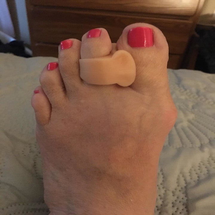 The same reviewer's toes now in alignment thanks to the toe separator
