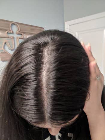 The same reviewer's scalp, but shiny and flake-free