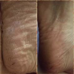 Reviewer before and after photo