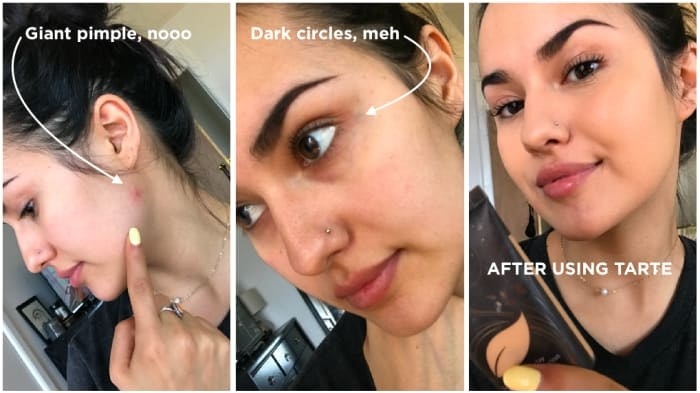BuzzFeed editor Kayla&#x27;s before/after pic using Tarte foundation. The after pic shows even skin coverage and hides dark circles and blemishes.