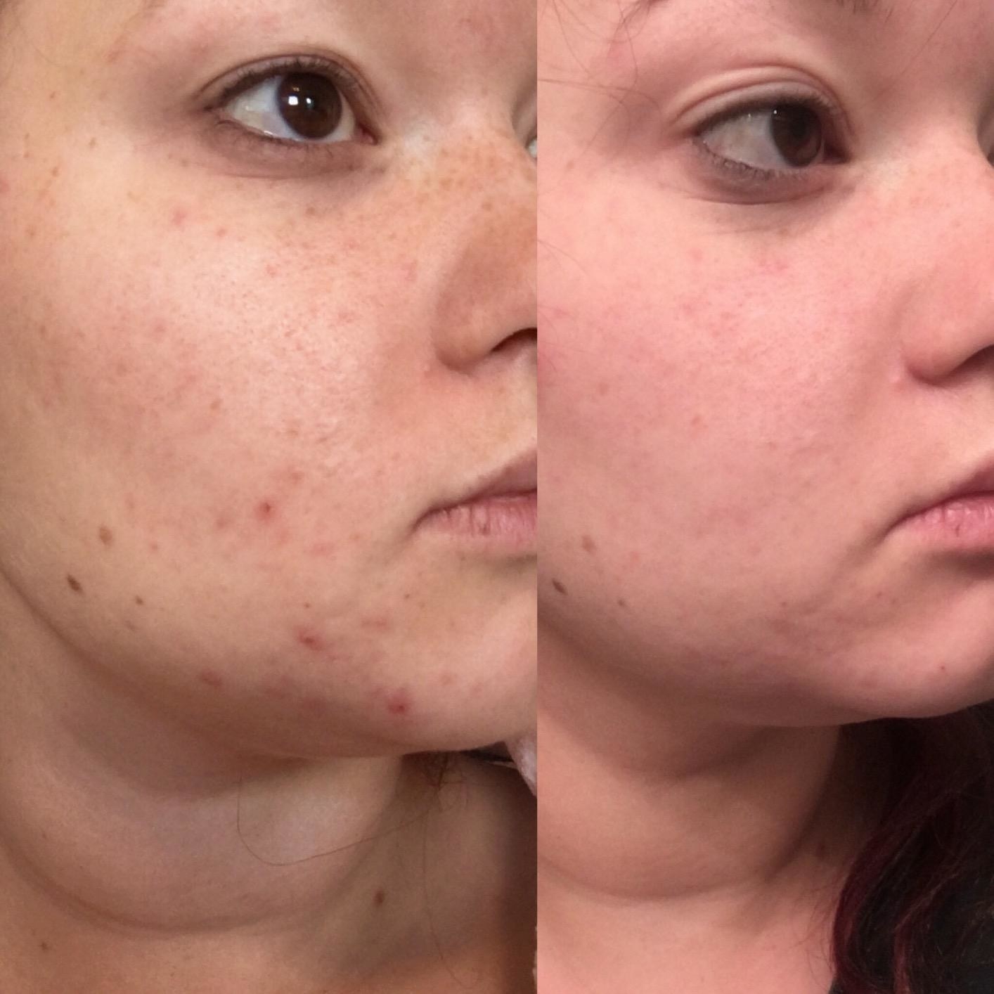on the left reviewer with a few breakouts, on the right the same reviewer with no breakouts