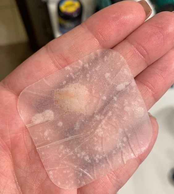 reviewer photo of them holding the extra large used acne patch