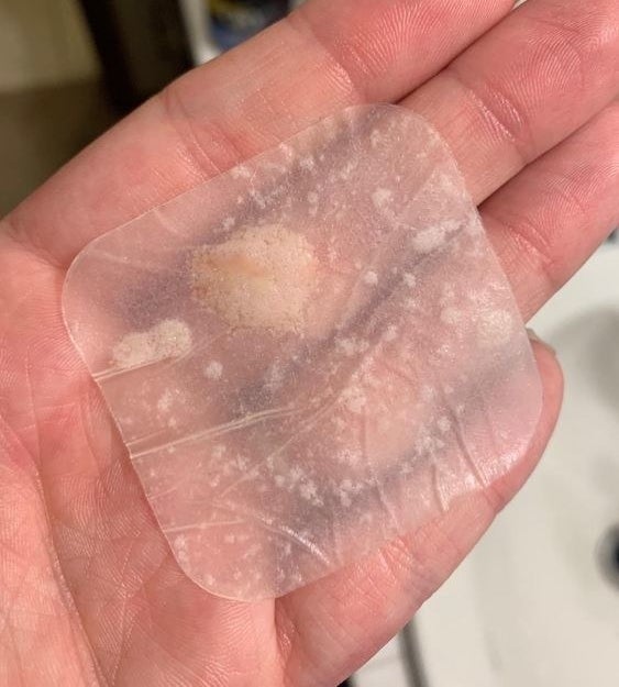 reviewer photo of them holding the extra large used acne patch