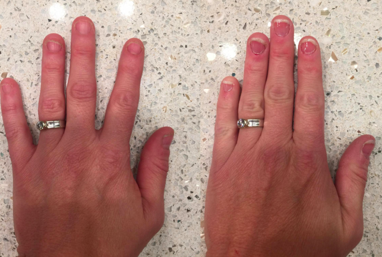 A customer review photo showing their hand before and after using Mavala Stop