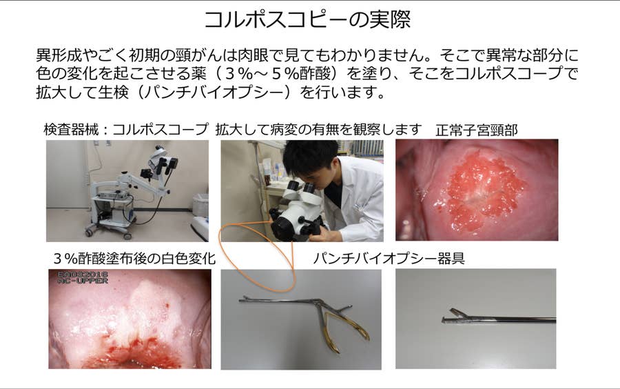 子宮頸癌・外陰癌の手術−理論と実際 (OGS NOW 5) | 櫻木 範明