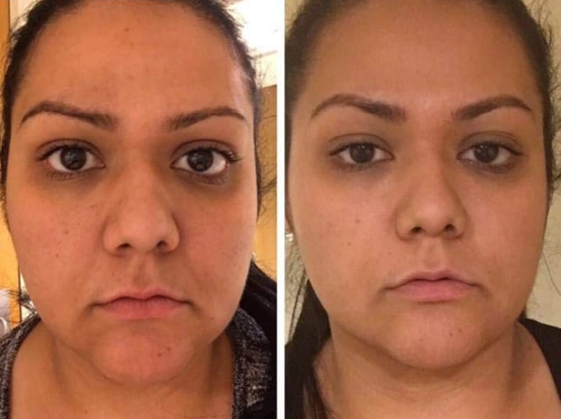 On the left, a reviewer showing they have bags under their eyes, and on the right, the same reviewer showing their bags are gone after using the repair cream