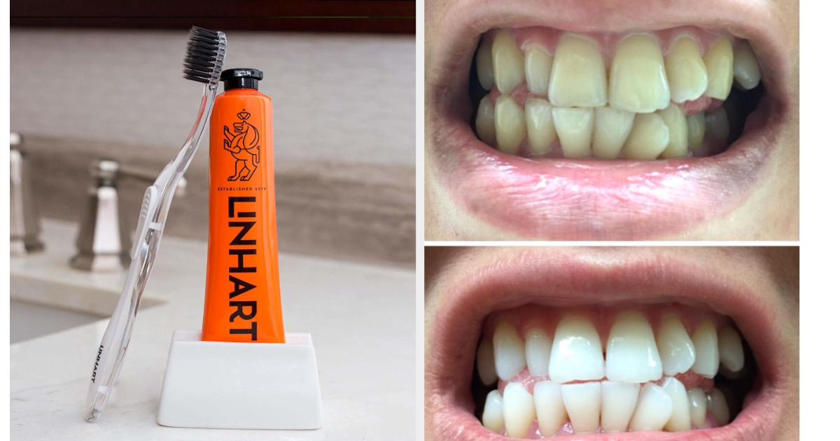 linhart tooth whitening gel