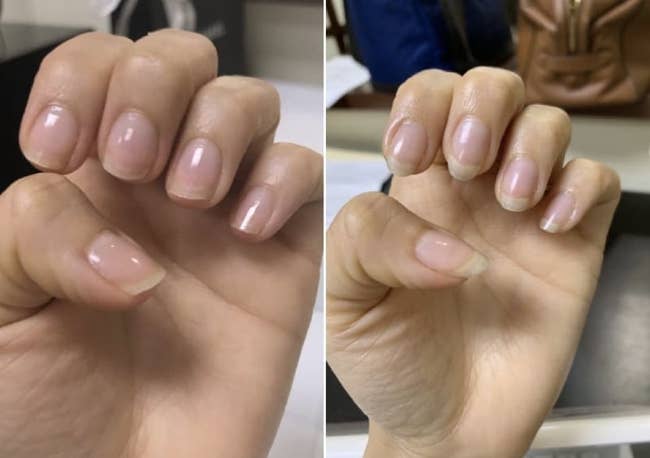 Reviewer's before/after image showing longer, healthier looking nails in the after image