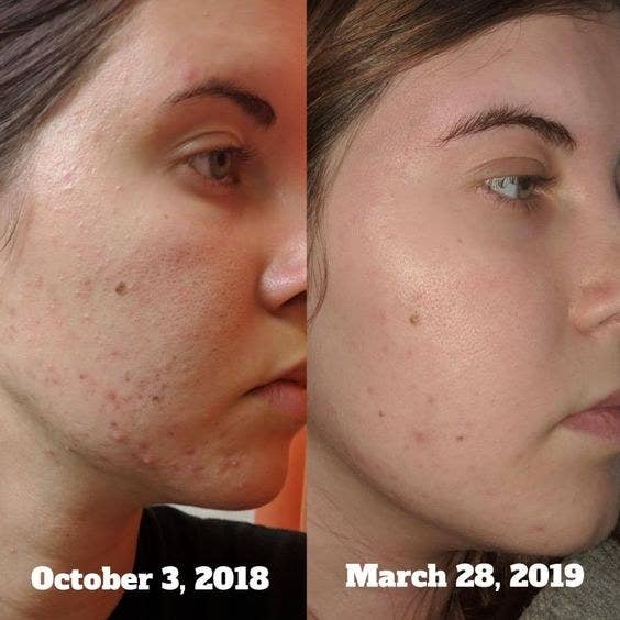 27 Hydrating Beauty Products For People With Dry Skin