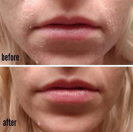 27 Hydrating Beauty Products For People With Dry Skin