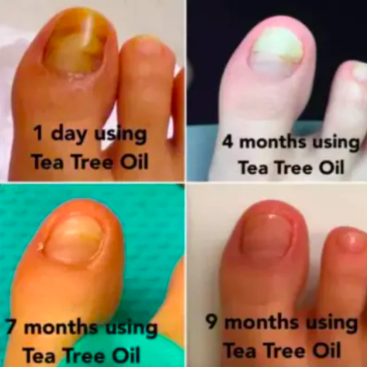 17 Products That Might Actually Help With Foot Fungus