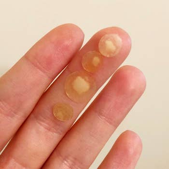 A reviewer holding four patches taken off their face and filled with dots of gunk