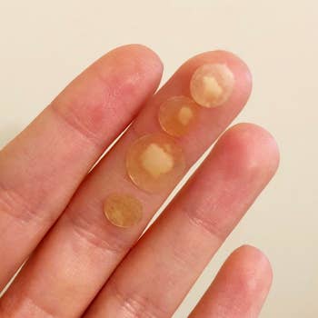A reviewer holding four patches taken off their face and filled with dots of gunk