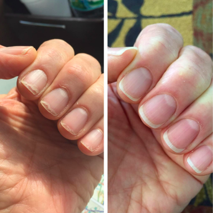 a before and after of a reviewer's nails with uneven edges and then looking long and smooth