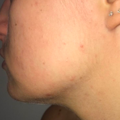 Reviewer's chin before use, with some blond hair