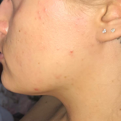 Reviewer after, with hair gone 