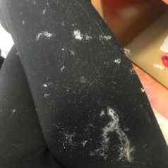 Reviewer showing all the hair fuzz that came off their face after use