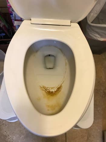 A reviewer's toilet bowl, which has dark yellow and brown stains on it