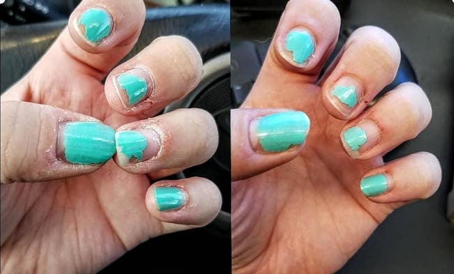 before photo of a reviewer's extremely dry hands and cracked cuticles and an after photo of the same hand looking much more moisturized and free of cracks