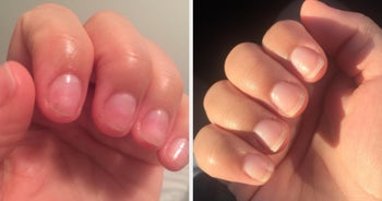 reviewer before-and-after pic showing how the cream 
made their nails so much longer and stronger
