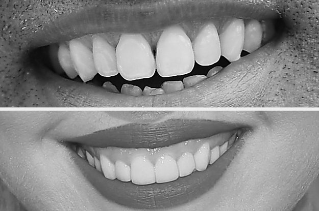 Can You Name The Celebrity Based On A Close-Up Of Their Teeth?