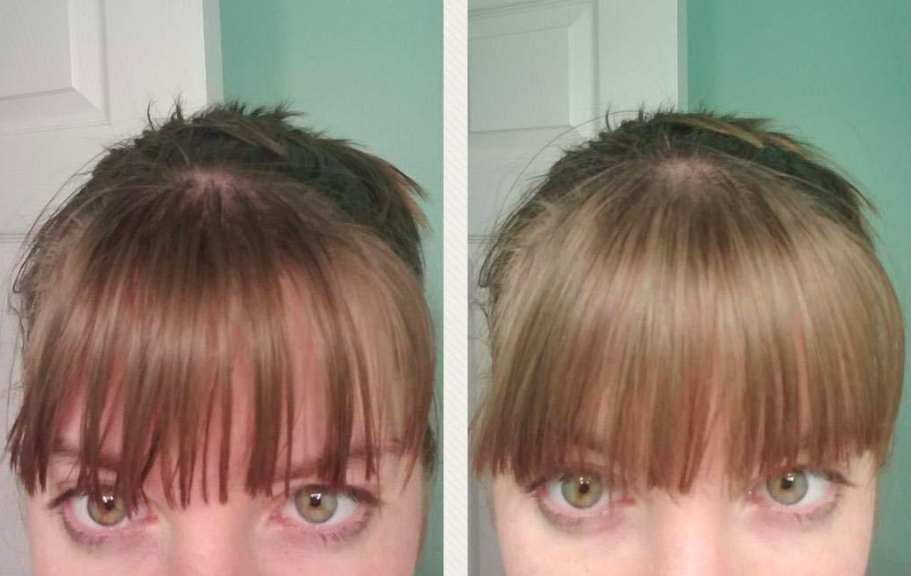 A reviewer with greasy bangs / A reviewer with clean bangs after using the product