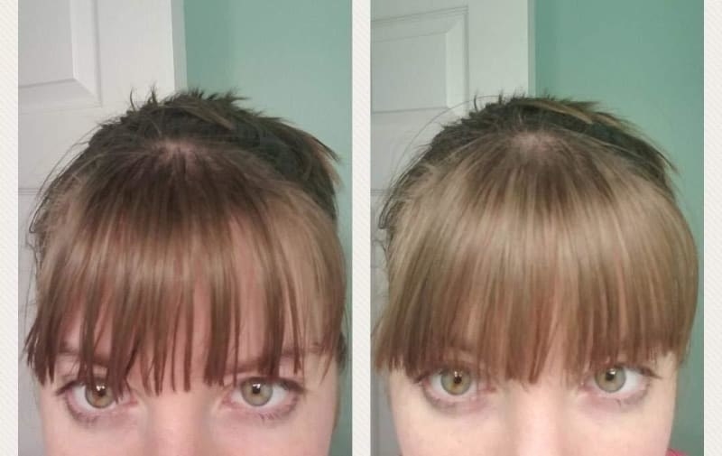 Reviewer&#x27;s before and after photos showing the powder made their formerly greasy bangs look freshly washed