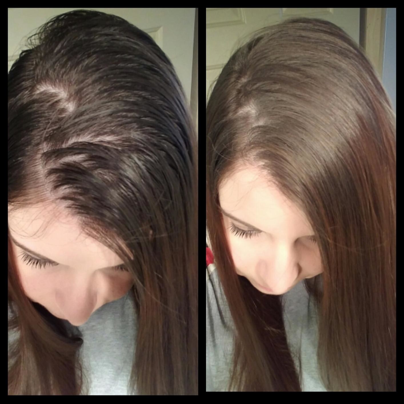 Сухой шампунь для волос до и после