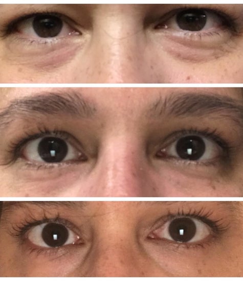 33 Ways To Solve All Your Most Annoying Beauty Problems