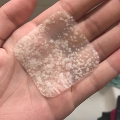 Reviewer photo of square acne patch that is filled with pimple discharge