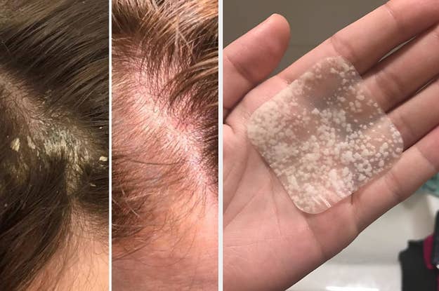 I Tried An All Natural Hair Removal Treatment And I M Never Gonna Wax Again