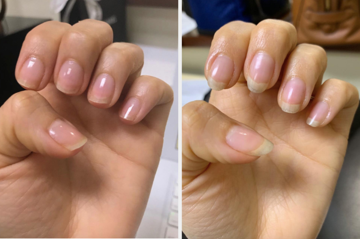 On the left, a reviewer&#x27;s nails looking short, and on the right, the same reviewer&#x27;s nails looking longer after using the cream