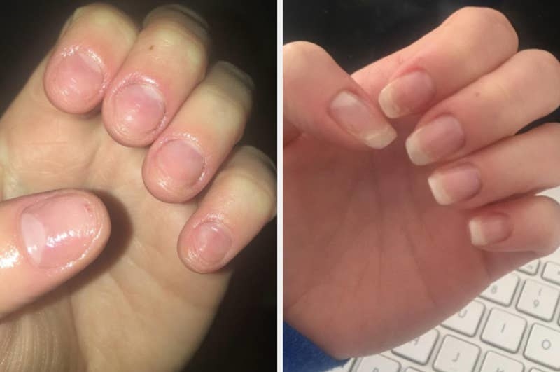 On the left, a reviewer&#x27;s nails looking short, and on the right, the same reviewer&#x27;s nails now looking longer