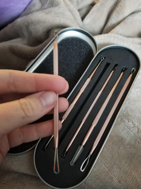 reviewer's hand holding one of the blackhead tools plus the case of four additional blackhead tools