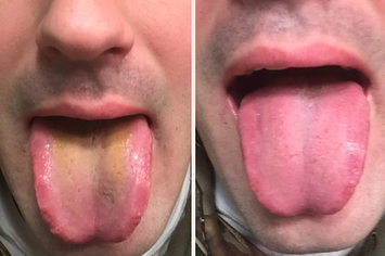 15 Products For Anyone Who's Sick Of Having Bad Breath