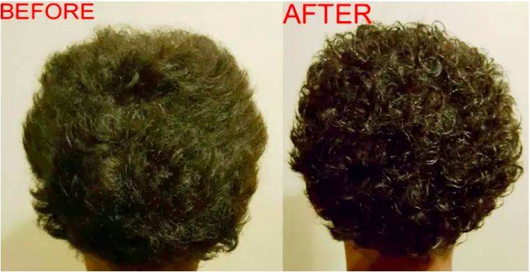 a before and after of a reviewers hair brushed out and next to it is their curls more defined by using the gel 