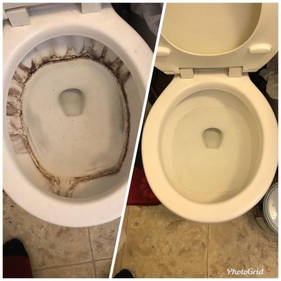 Reviewer&#x27;s before and after of their dirty, stained toilet and then clean toilet bowl