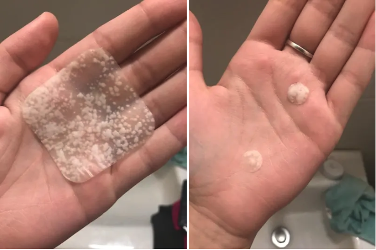 A reviewer's hand in two photos: on the left holding the large square patch with absorbed pus all over, and on the right holding two smaller round patches with absorbed pus
