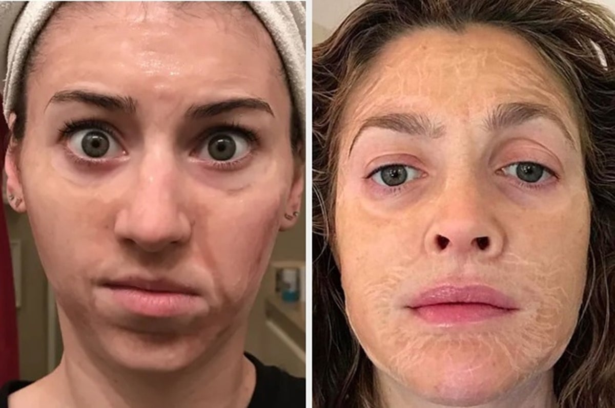 I Tried The Mask That Celebrities Influencers Rave And DAMN