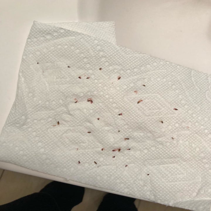 Paper towel covered in dead ticks