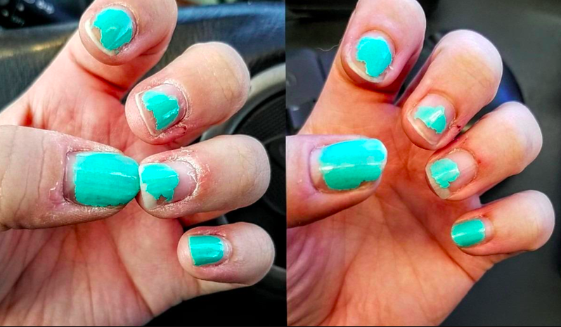 reviewers&#x27; before pic with painfully dry looking hands, then properly moisturized hands