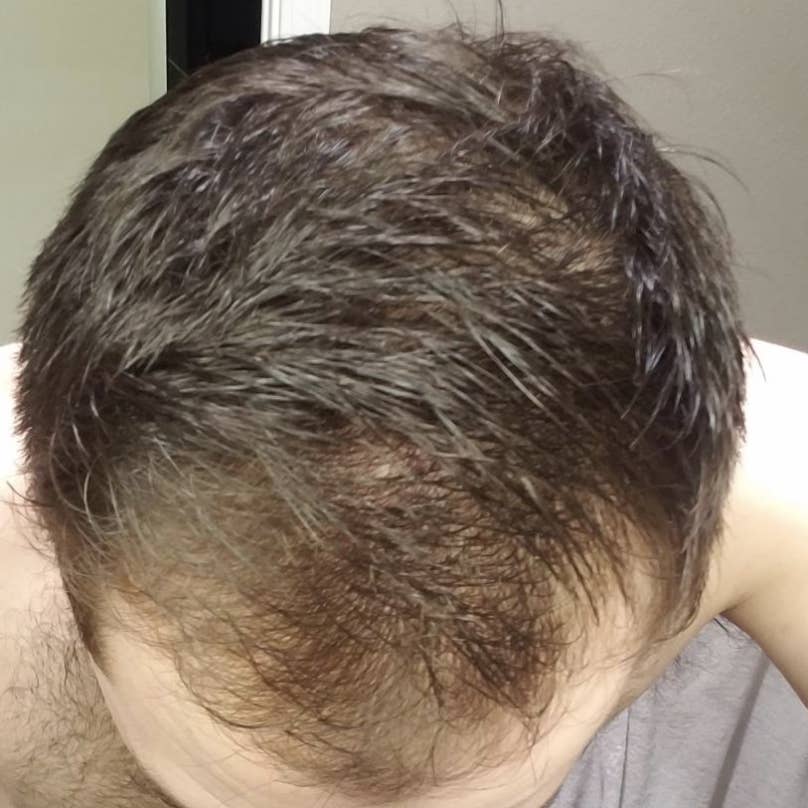 33 Face And Hair Treatments With Noticeable Results