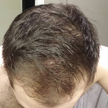 Top down image of reviewer showing signs of hair thinning