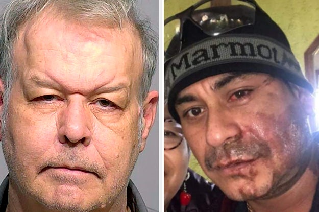 A White Man Allegedly Threw Battery Acid On A Latino Man's Face And Told Him To Go Back To His Country